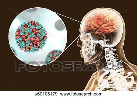 Venezuelan equine encephalitis viruses infecting human brain, computer illustration. This mosquito-borne virus can cause fatal brain and spinal cord inflammation in horses. It can also cause a fatal fever in humans. In viruses, the capsid is the... View Large Photo Image Stock Photo - Venezuelan equine encephalitis viruses infecting human brain, computer illustration. This mosquito-borne virus can cause fatal brain and spinal cord inflammation in horses. It can also cause a fatal fever in humans. In viruses, the capsid is the.... Fotosearch
