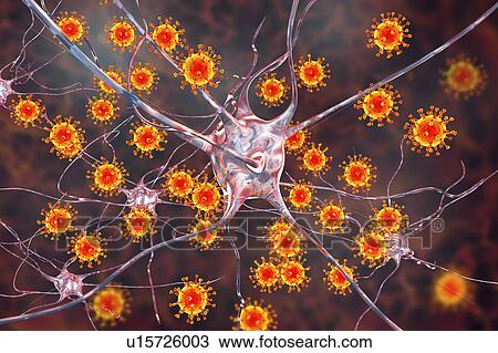Stock Image - Viral encephalitis. Conceptual illustration showing viruses infecting neurons.. Fotosearch