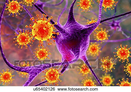 Viral encephalitis. Conceptual illustration showing viruses infecting neurons. View Large Photo Image Stock Photograph - Viral encephalitis. Conceptual illustration showing viruses infecting neurons.. Fotosearch