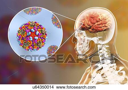 Western equine encephalitis viruses infecting human brain, computer illustration. This is an RNA (ribonucleic acid) virus from the Alphavirus genus. It is an arbovirus (arthropod-borne virus) and is transmitted to humans, birds and horses by mosquito... View Large Photo Image Picture - Western equine encephalitis viruses infecting human brain, computer illustration. This is an RNA (ribonucleic acid) virus from the Alphavirus genus. It is an arbovirus (arthropod-borne virus) and is transmitted to humans, birds and horses by mosquito.... Fotosearch