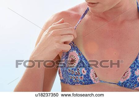 Woman with sunburnt chest. View Large Photo Image Stock Image - Woman with sunburnt chest.. Fotosearch