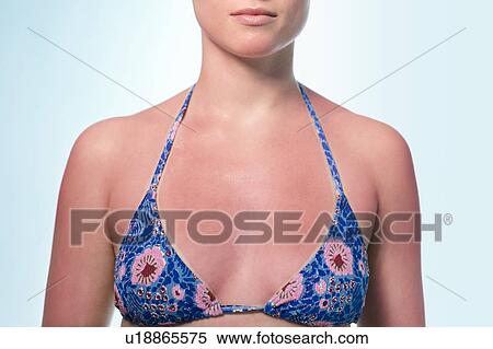 Stock Photography - Woman with sunburnt chest.. Fotosearch