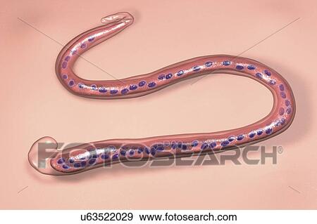 Wuchereria bancrofti. Computer illustration of the microfilaria larval stage of the parasitic worm Wuchereria bancrofti, which causes filariasis in humans. W. bancrofti larvae are also found in several mosquito hosts. They enter the human body as the... View Large Photo Image Stock Photo - Wuchereria bancrofti. Computer illustration of the microfilaria larval stage of the parasitic worm Wuchereria bancrofti, which causes filariasis in humans. W. bancrofti larvae are also found in several mosquito hosts. They enter the human body as the.... Fotosearch