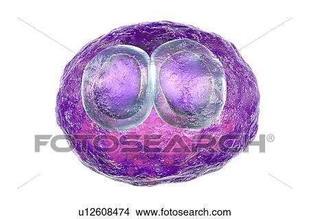 Picture - Cytomegalovirus infection. Computer illustration of human cells showing cytomegalic inclusion disease, a symptom of cytomegalovirus infection. Cytomegalovirus (CMV) particles invade cell nuclei, causing the appearance of darker bodies within them.... Fotosearch