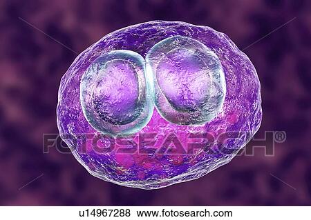 Stock Photo - Cytomegalovirus infection. Computer illustration of human cells showing cytomegalic inclusion disease, a symptom of cytomegalovirus infection. Cytomegalovirus (CMV) particles invade cell nuclei, causing the appearance of darker bodies within them.... Fotosearch