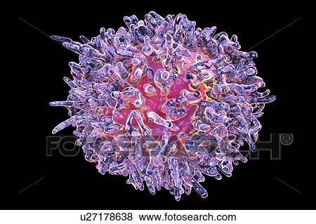 Hairy cell leukaemia. Computer illustration of abnormal white blood cell (B- lymphocyte) from a patient with hairy cell leukaemia. These cells show characteristic hair-like cytoplasmic projections and ruffles on their surfaces. Leukaemia is a blood... View Large Photo Image Stock Photo - Hairy cell leukaemia. Computer illustration of abnormal white blood cell (B- lymphocyte) from a patient with hairy cell leukaemia. These cells show characteristic hair-like cytoplasmic projections and ruffles on their surfaces. Leukaemia is a blood.... Fotosearch