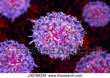 Stock Photo - Hairy cell leukaemia. Computer illustration of abnormal white blood cells (B- lymphocytes) from a patient with hairy cell leukaemia. These cells show characteristic hair-like cytoplasmic projections and ruffles on their surfaces. Leukaemia is a blood.... Fotosearch