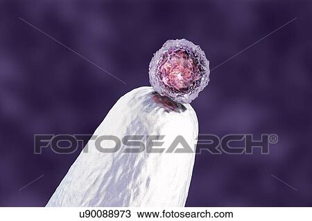 Stock Image - Human embryonic stem cell on a pin tip, conceptual computer illustration.. Fotosearch