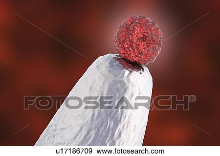 Stock Photo - Human embryonic stem cell on a pin tip, conceptual computer illustration.. Fotosearch