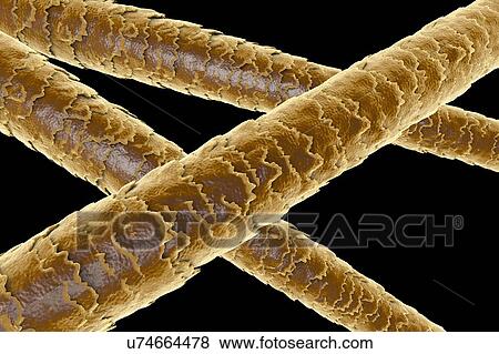Human hair shafts, computer illustration. The outer layer of the hair shaft (the cuticle) can be seen, with overlapping scales of dead cells. The scales are thought to be important in preventing matting of the hair. Hair is made up of dead cells... View Large Photo Image Stock Photo - Human hair shafts, computer illustration. The outer layer of the hair shaft (the cuticle) can be seen, with overlapping scales of dead cells. The scales are thought to be important in preventing matting of the hair. Hair is made up of dead cells.... Fotosearch