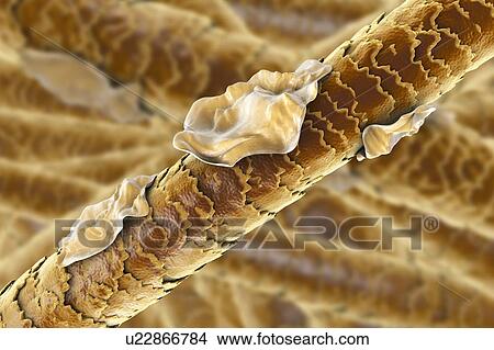 Picture - Human hair with dandruff, computer illustration.. Fotosearch