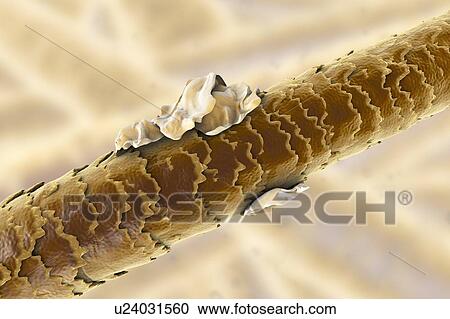 Stock Image - Human hair with dandruff, computer illustration.. Fotosearch