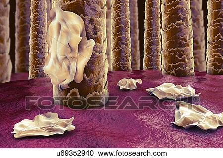 Stock Image - Human scalp with dandruff, computer illustration.. Fotosearch