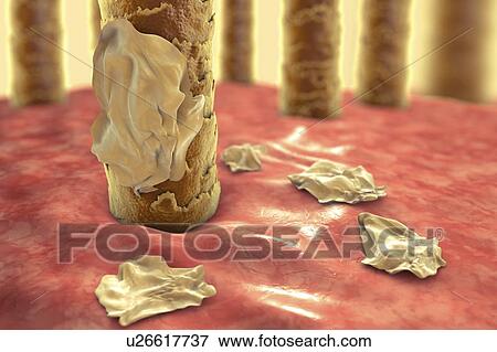 Human scalp with dandruff, computer illustration. View Large Photo Image Stock Photo - Human scalp with dandruff, computer illustration.. Fotosearch