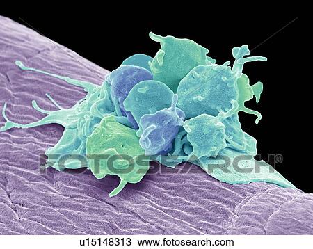 Stock Image - Activated platelets. Coloured scanning electron micrograph (SEM) of activated platelets attached to surgical gauze. Platelets are tiny blood cells that help the body form clots to stop bleeding. If a blood vessels gets damaged, it sends out signals.... Fotosearch