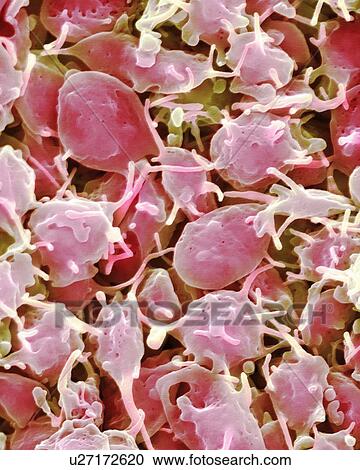 Activated platelets, coloured scanning electron micrograph (SEM). Platelets are blood cell fragments that play an essential role in blood clotting and wound repair, and can also activate certain immune responses. They are formed in the red bone... View Large Photo Image Stock Image - Activated platelets, coloured scanning electron micrograph (SEM). Platelets are blood cell fragments that play an essential role in blood clotting and wound repair, and can also activate certain immune responses. They are formed in the red bone.... Fotosearch