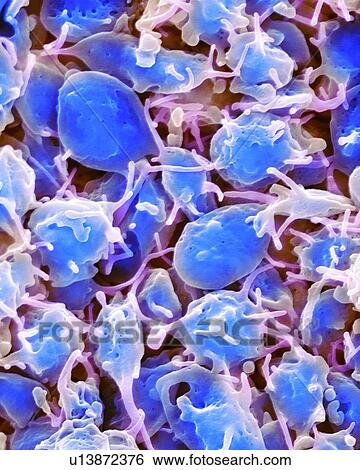 Activated platelets, coloured scanning electron micrograph (SEM). Platelets are blood cell fragments that play an essential role in blood clotting and wound repair, and can also activate certain immune responses. They are formed in the red bone... View Large Photo Image Stock Photograph - Activated platelets, coloured scanning electron micrograph (SEM). Platelets are blood cell fragments that play an essential role in blood clotting and wound repair, and can also activate certain immune responses. They are formed in the red bone.... Fotosearch