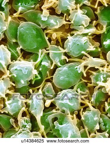 Activated platelets, coloured scanning electron micrograph (SEM). Platelets are blood cell fragments that play an essential role in blood clotting and wound repair, and can also activate certain immune responses. They are formed in the red bone... View Large Photo Image Stock Photography - Activated platelets, coloured scanning electron micrograph (SEM). Platelets are blood cell fragments that play an essential role in blood clotting and wound repair, and can also activate certain immune responses. They are formed in the red bone.... Fotosearch