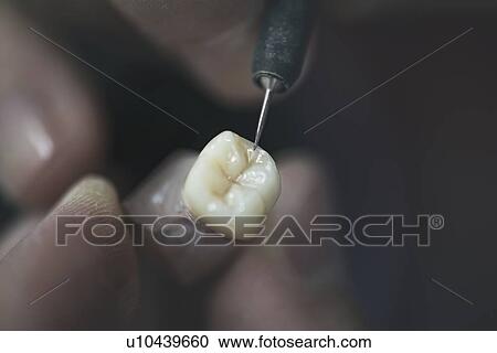 Stock Image - Artificial tooth being made.. Fotosearch