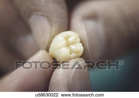 Stock Image - Artificial tooth being made.. Fotosearch