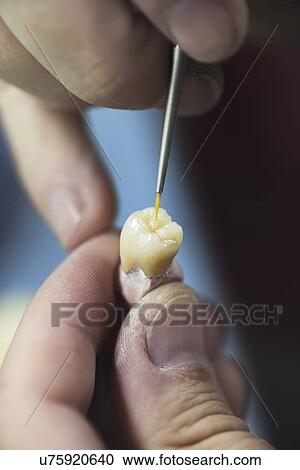 Stock Image - Artificial tooth being made.. Fotosearch