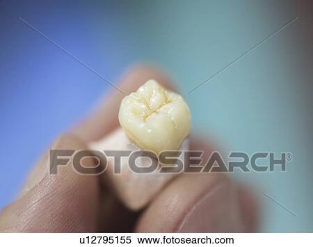 Stock Photography - Artificial tooth being made.. Fotosearch