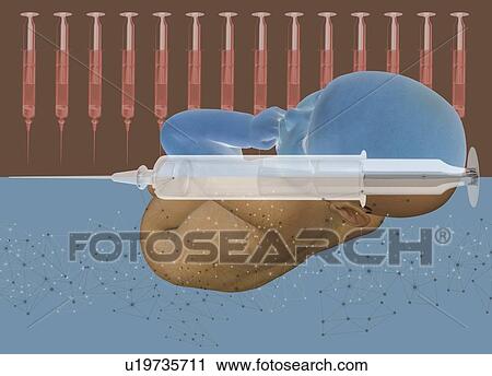 Stock Image - Baby and injections, illustration.. Fotosearch