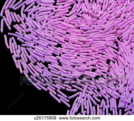 Bacillus megaterium bacterial colony, coloured scanning electron micrograph (SEM). This rod-shaped Gram positive bacteria is found in soil. It is one of the biggest bacterial cells, measuring up to four micrometres in length. Because of this it is a... View Large Photo Image Stock Photo - Bacillus megaterium bacterial colony, coloured scanning electron micrograph (SEM). This rod-shaped Gram positive bacteria is found in soil. It is one of the biggest bacterial cells, measuring up to four micrometres in length. Because of this it is a.... Fotosearch