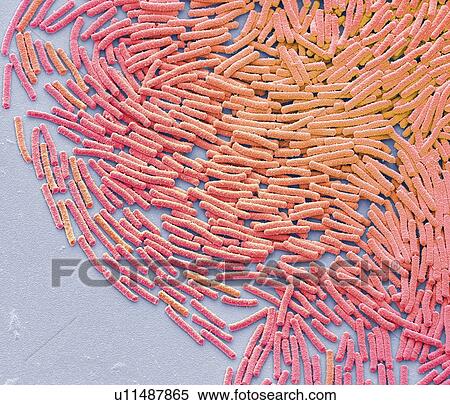 Stock Photography - Bacillus megaterium bacterial colony, coloured scanning electron micrograph (SEM). This rod-shaped Gram positive bacteria is found in soil. It is one of the biggest bacterial cells, measuring up to four micrometres in length. Because of this it is a.... Fotosearch
