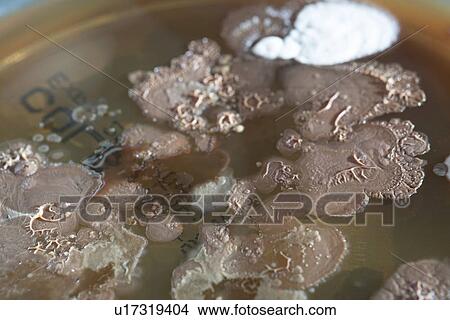 Bacterial colonies growing in Petri dish. View Large Photo Image Picture - Bacterial colonies growing in Petri dish.. Fotosearch