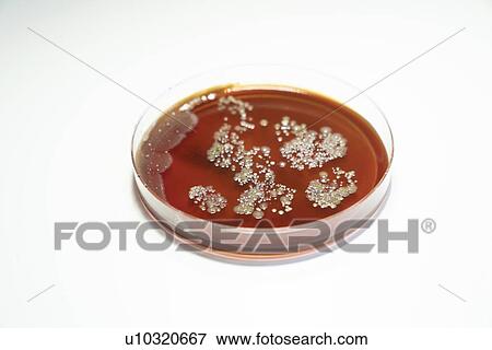 Stock Photo - Bacterial colonies growing in Petri dish.. Fotosearch