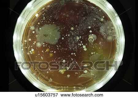 Stock Photo - Bacterial colonies growing in Petri dish.. Fotosearch