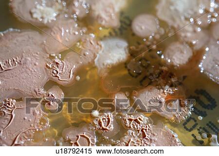 Stock Photography - Bacterial colonies growing in Petri dish.. Fotosearch