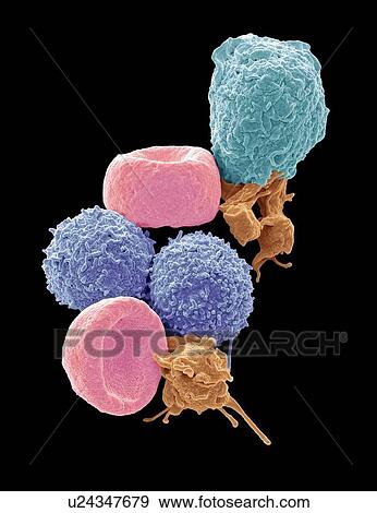 Blood cells. Coloured scanning electron micrograph (SEM) of human red blood cells (erythrocytes, red), white blood cells (leukocytes, blue and cyan), and platelets (thrombocytes, orange). The disc-shaped, biconcave erythrocytes transport oxygen to the... View Large Photo Image Stock Photo - Blood cells. Coloured scanning electron micrograph (SEM) of human red blood cells (erythrocytes, red), white blood cells (leukocytes, blue and cyan), and platelets (thrombocytes, orange). The disc-shaped, biconcave erythrocytes transport oxygen to the.... Fotosearch