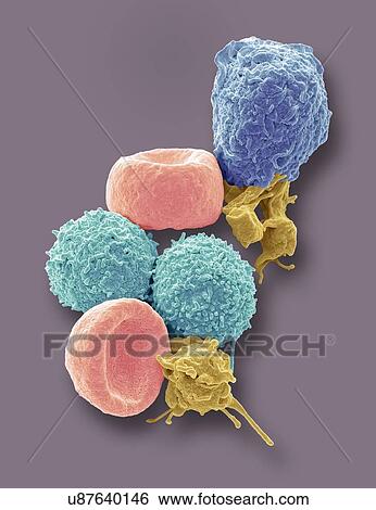 Blood cells. Coloured scanning electron micrograph (SEM) of human red blood cells (erythrocytes, red), white blood cells (leukocytes, blue and cyan), and platelets (thrombocytes, yellow). The disc-shaped, biconcave erythrocytes transport oxygen to the... View Large Photo Image Stock Photograph - Blood cells. Coloured scanning electron micrograph (SEM) of human red blood cells (erythrocytes, red), white blood cells (leukocytes, blue and cyan), and platelets (thrombocytes, yellow). The disc-shaped, biconcave erythrocytes transport oxygen to the.... Fotosearch