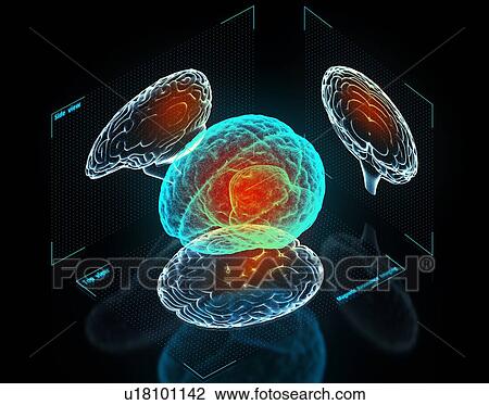 Brain with pain center. Virtual digital imaging. 3d illustration. View Large Photo Image Stock Image - Brain with pain center. Virtual digital imaging. 3d illustration.. Fotosearch