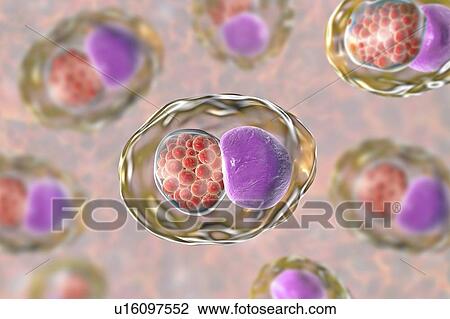 Stock Image - Chlamydia trachomatis bacteria. Computer illustration showing an inclusion composed of a group of chlamydia reticulate bodies (intracellular multiplying stage, small red spheres) near the nucleus (purple) of a cell. Chlamydia trachomatis causes a.... Fotosearch