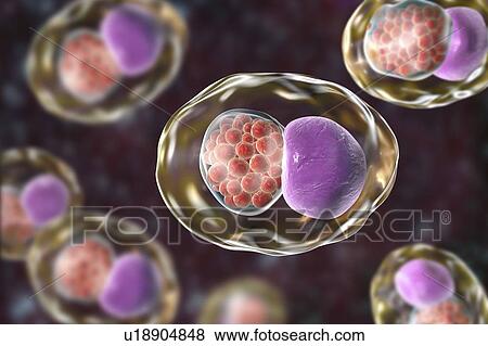 Chlamydia trachomatis bacteria. Computer illustration showing an inclusion composed of a group of chlamydia reticulate bodies (intracellular multiplying stage, small red spheres) near the nucleus (purple) of a cell. Chlamydia trachomatis causes a... View Large Photo Image Stock Photo - Chlamydia trachomatis bacteria. Computer illustration showing an inclusion composed of a group of chlamydia reticulate bodies (intracellular multiplying stage, small red spheres) near the nucleus (purple) of a cell. Chlamydia trachomatis causes a.... Fotosearch