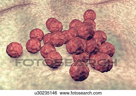 Stock Photograph - Chlamydia trachomatis bacteria, computer illustration. Chlamydia trachomatis causes a sexually transmitted infection that can go undetected causing infertility. It also causes the eye disease trachoma, which can lead to blindness.. Fotosearch