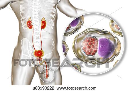 Stock Image - Chlamydial infection. Computer illustration of an urethral smear showing infection with the bacteria Chlamydia trachomatis. Chlamydia survive by infecting host cells and forming inclusion bodies, where they reproduce. New bacteria are released by.... Fotosearch