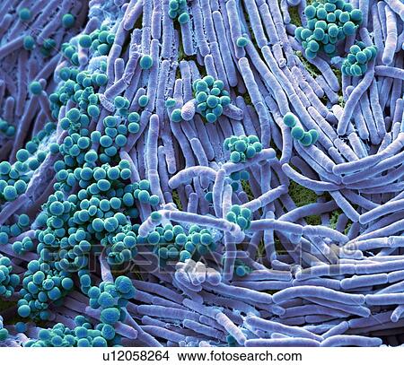 Picture - Coloured scanning electron micrograph (SEM) of bacteria cultured from a mobile phone. Tests have revealed the average handset carries 18 times more potentially harmful germs than a flush handle in a men's toilet. With frequent use phones remain warm,.... Fotosearch