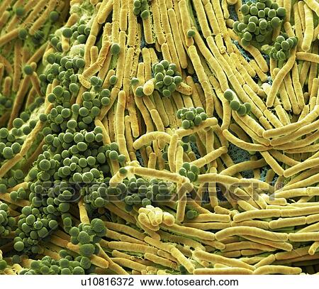 Stock Image - Coloured scanning electron micrograph (SEM) of bacteria cultured from a mobile phone. Tests have revealed the average handset carries 18 times more potentially harmful germs than a flush handle in a men's toilet. With frequent use phones remain warm,.... Fotosearch