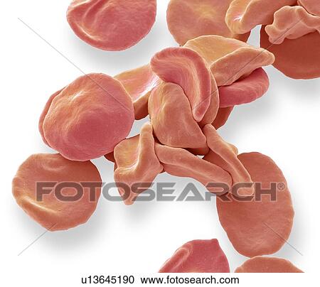Coloured scanning electron micrograph (SEM) of red blood cells (RBCs, erythrocytes). Red blood cells are biconcave, disc-shaped cells that transport oxygen from the lungs to body cells. They circulate in the blood and also remove carbon dioxide to the... View Large Photo Image Stock Image - Coloured scanning electron micrograph (SEM) of red blood cells (RBCs, erythrocytes). Red blood cells are biconcave, disc-shaped cells that transport oxygen from the lungs to body cells. They circulate in the blood and also remove carbon dioxide to the.... Fotosearch