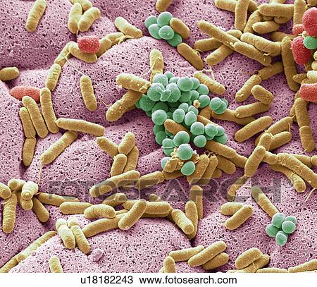 Stock Image - Coloured scanning electron micrograph (SEM) of bacteria cultured from a used dishcloth. Dishcloths can have six times as many bacteria as toilet handles according to some studies. They often harbour harmful E. coli bacteria, which can cause diarrhoea.... Fotosearch