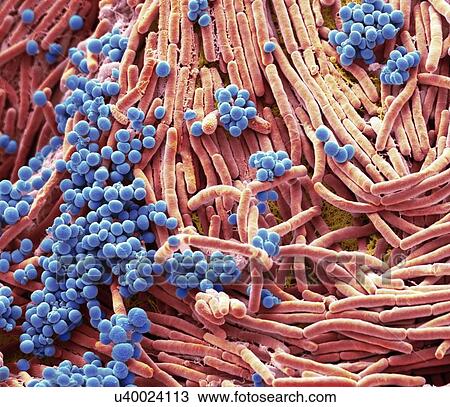 Coloured scanning electron micrograph (SEM) of bacteria cultured from a mobile phone. Tests have revealed the average handset carries 18 times more potentially harmful germs than a flush handle in a men's toilet. With frequent use phones remain warm,... View Large Photo Image Stock Image - Coloured scanning electron micrograph (SEM) of bacteria cultured from a mobile phone. Tests have revealed the average handset carries 18 times more potentially harmful germs than a flush handle in a men's toilet. With frequent use phones remain warm,.... Fotosearch