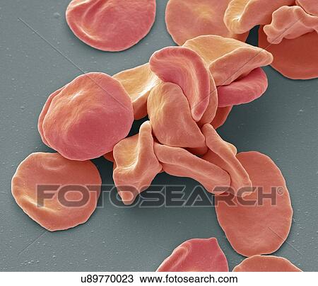 Stock Image - Coloured scanning electron micrograph (SEM) of red blood cells (RBCs, erythrocytes). Red blood cells are biconcave, disc-shaped cells that transport oxygen from the lungs to body cells. They circulate in the blood and also remove carbon dioxide to the.... Fotosearch