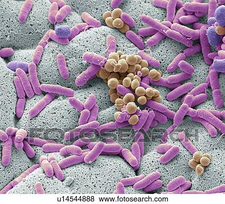 Stock Photo - Coloured scanning electron micrograph (SEM) of bacteria cultured from a used dishcloth. Dishcloths can have six times as many bacteria as toilet handles according to some studies. They often harbour harmful E. coli bacteria, which can cause diarrhoea.... Fotosearch