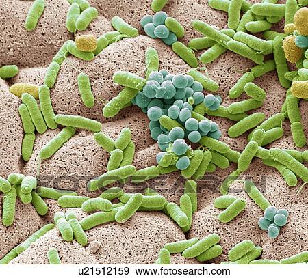Stock Photo - Coloured scanning electron micrograph (SEM) of bacteria cultured from a used dishcloth. Dishcloths can have six times as many bacteria as toilet handles according to some studies. They often harbour harmful E. coli bacteria, which can cause diarrhoea.... Fotosearch