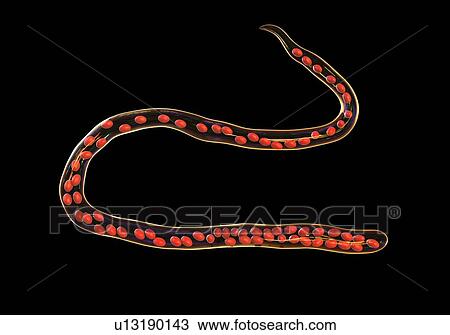 Computer illustration of Mansonella ozzardi, a roundworm nematode that causes serous cavity filariasis and keratitis in humans. Note the absence of a sheath around the worm and tail nuclei that do not extend to the tail tip. View Large Photo Image Stock Image - Computer illustration of Mansonella ozzardi, a roundworm nematode that causes serous cavity filariasis and keratitis in humans. Note the absence of a sheath around the worm and tail nuclei that do not extend to the tail tip.. Fotosearch