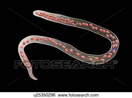 Stock Photograph - Computer illustration of Mansonella ozzardi, a roundworm nematode that causes serous cavity filariasis and keratitis in humans. Note the absence of a sheath around the worm and tail nuclei that do not extend to the tail tip.. Fotosearch